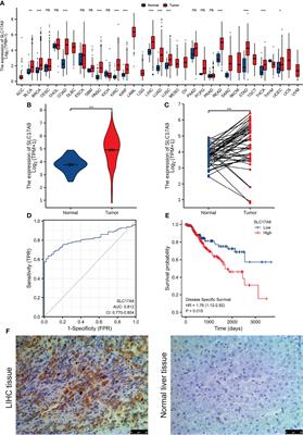 Comprehensive Analysis of SLC17A9 and Its Prognostic Value in Hepatocellular Carcinoma